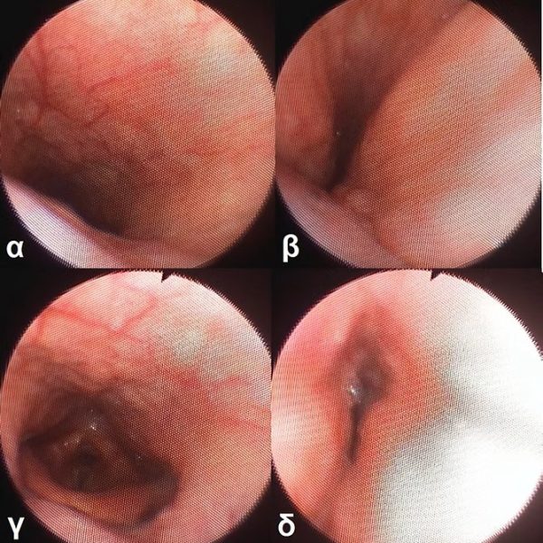 rogxopatheion6
