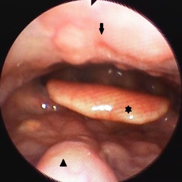 rogxopatheion9