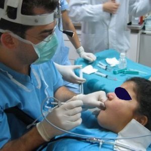 sialendoscopisi2