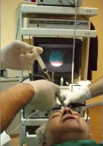 sialendoscopisi3